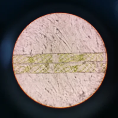 Spirogyra Algae under a Microscope